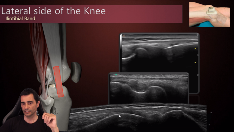 inigoiri's tweet photo. Soon I will release my next video:

Knee  Anatomy &amp; US (Part 3/4): Lateral side

If you want to be informed about new videos, suscribe to my YouTube channel following this link:

https://t.co/tSnc6ztaJz https://t.co/oTU4cRbUsU