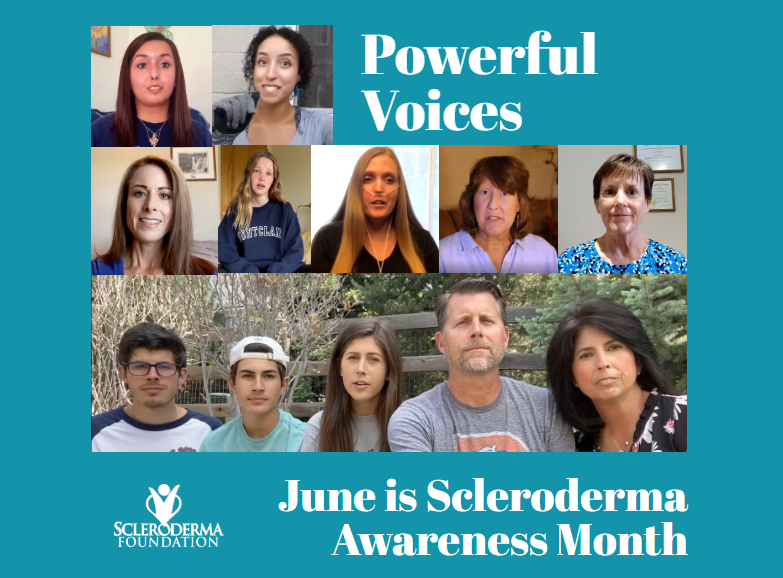 SclerodermaCO's tweet image. Hear their voice. Learn about scleroderma. youtu.be/sRn_u7q8YDo
Comment, like and share! Help us spread awareness of scleroderma and support the Rocky Mt. Chapter by making a donation today: bit.ly/3drnAAq
#SclerodermaAware #Scleroderma #DidYouKnow