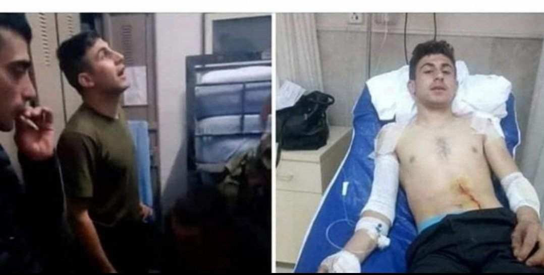 Alt devrelere racon kesen zibidi merdivenlerden düşmüş 😁