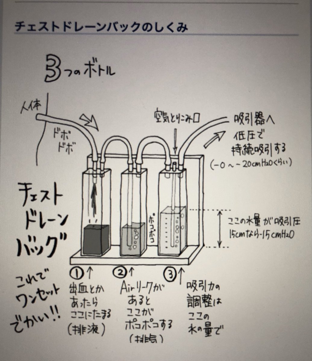 胸腔 ドレーン 抜去