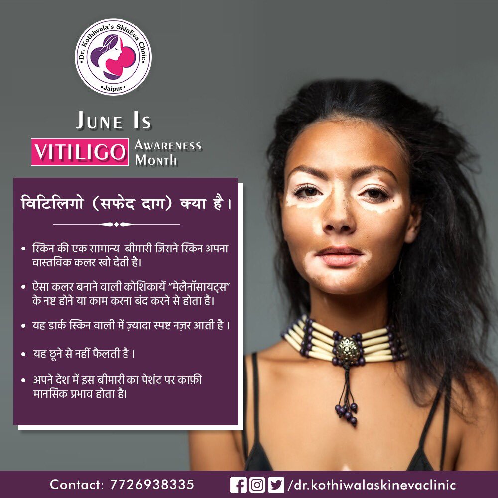 DrSkothiwalaMD's tweet image. June Is Vitiligo Awareness Month. #vitiligo #VitiligoAwarenessMonth #leukoderma #safeddaag #Jaipur #Jaipurdermatologist