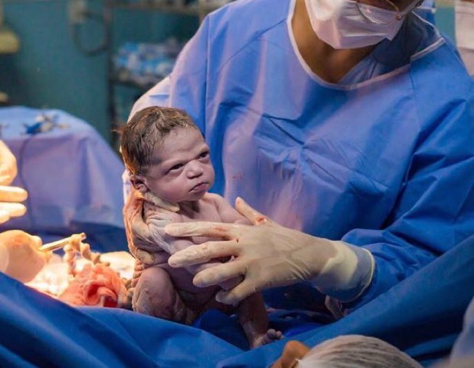 MALIKYONCEE's tweet image. os bebês da zoraida e da Dulce nascendo e vendo que n são filhos do Eddy Vilard e Christopher