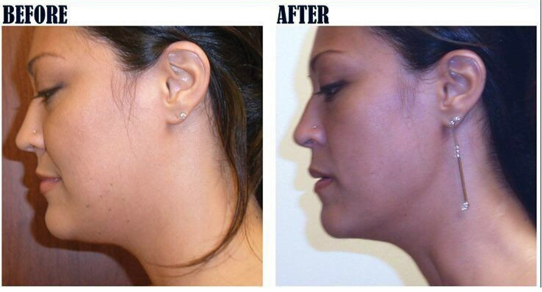 ArtBudding's tweet photo. DERMACARE #skintightening #toningbody (480) 907 - 5220 #bodysculpting #nurses #dermatologist #slimdown #dr @AzSeasonsMag @AzSeasons @keaki1992 https://t.co/FMWORBKyRC https://t.co/MP1PdrSwwk