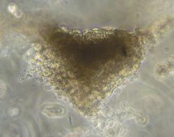 UTSResearch's tweet photo. A team at UTS led by @carmine_3Dheart who have been working on 3D-printed “mini hearts” to repair damage from cardiovascular disease are refocusing their efforts to help address the immediate threat of COVID-19 to patients with underlying heart disease. https://t.co/Q9ndRozJ2K https://t.co/RiNsCazFuF