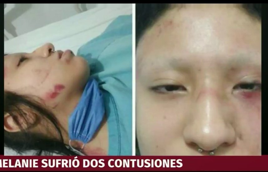 EmilianoTorren1's tweet photo. @telediario @Carloszup @paobarquet #Melanie #Anarquistas #PoderosoBarrio #coronavirus #8Junio #Covid_19 #GiovaniLopez #AdoroLosFinalesFelices 😂🤣 que bien se te ve la jeta así #Melanie y vaya que estás pinche fea...a eso se le llama #Karma a toda acción una reacción @GobCDMX @SSC_CDMX bien x esos polis una 🍺 https://t.co/tIbi6Ma8Xs