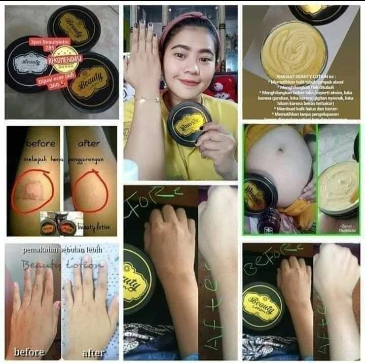 AyuViral's tweet photo. Klo mantan meninggalkan luka🙊
Beauty Lotion menghilangkan bekas luka🥰
Klo mantan bikin galau😓
Red jelly bikin berkilau😄
Ready stok say😍😍😍
Yukkl di keeep say
Yg mw glowing di hari raya... https://t.co/1hM75dx3gW