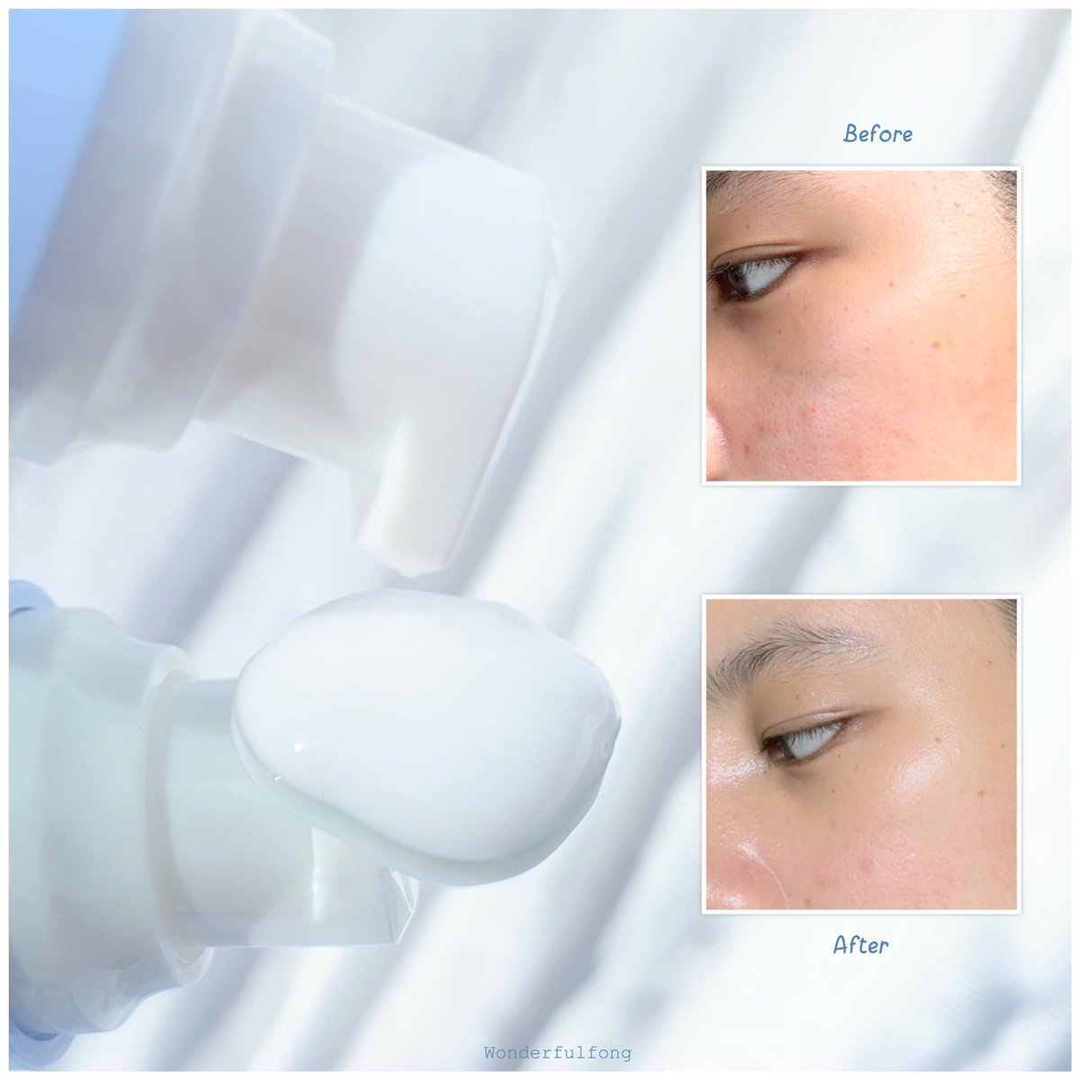 Wonderfulfong's tweet image. ก่อนนี้ใช้ยาสิวจนผิวแห้งลอกเป็นขุย เลยหาสกินแคร์เติมความชุ่มชื่น ไปเจอตัวนี้ของ #cutepress เป็นmoisture milk ช่วยให้ความชุ่มชื่นดีมากๆสกัดจากโปรตีนน้ำนม+อัลมอนด์+น้ำมันจากเมล็ดโฮโฮบา🥛🌰🥜ทาก่อนนอนไม่กี่คืนผิวกลับมาชุ่มชื่นเหมือนเดิม ทับใจ 229฿ #MoistureMilk #เซ็ตหน้านุ่มชุ่มชื่น