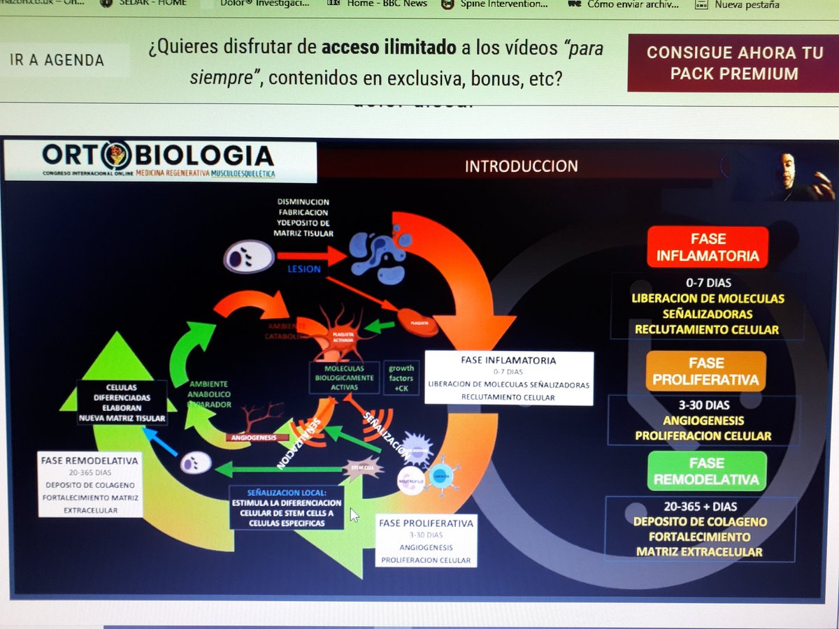 Muy buena charla de <a href="/Sebopi/">Sergi Boada Pie</a> en el primer congreso de Ortobiologia. Explicando conceptos y definiciones de la medicina regenerativa