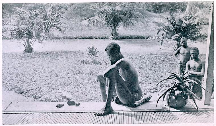 This Congolese man is staring at the severed hand and foot of his 5 year old daughter - punishment for not collecting enough rubber for Belgian King Leopold II. Today people are complaining because a statue of King Leopold has been taken down in Antwerp.