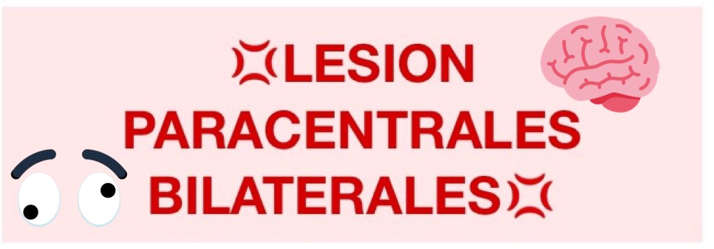 stephanyabudc's tweet photo. * APRAXIA PARA LA MARCHA —> dificultad para realizar la marcha, sobre todo en la iniciación del movimiento. ⬇️⬇️⬇️ https://t.co/jjgcqhwKwA