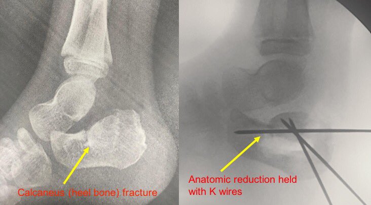 Zachary Vaupel tweet media