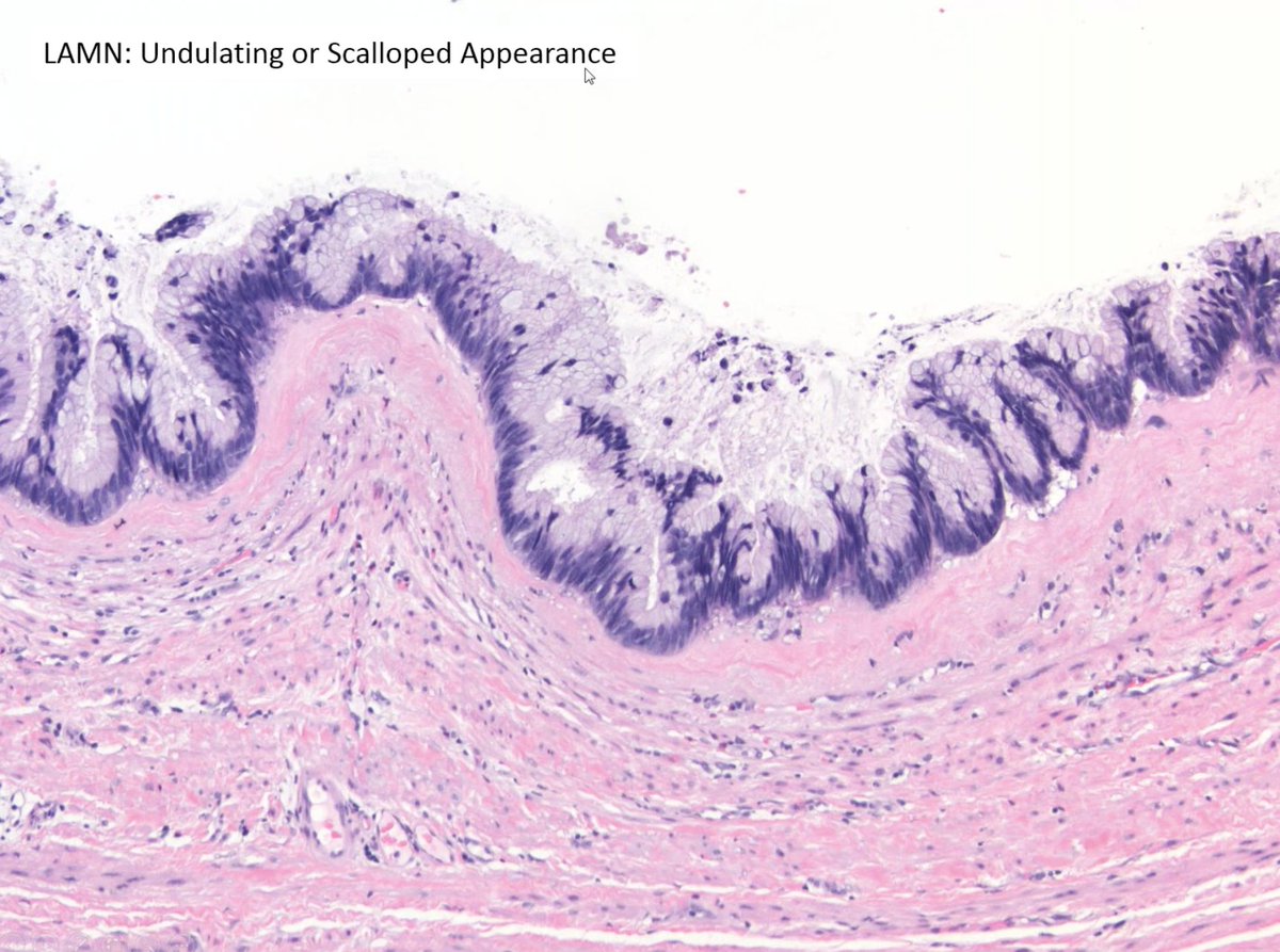 ALBoothMD's tweet photo. LAMN vs SSL -> look for your layers! @pezhouh #CAPvirtualpath #gipath https://t.co/hZEjryhooh