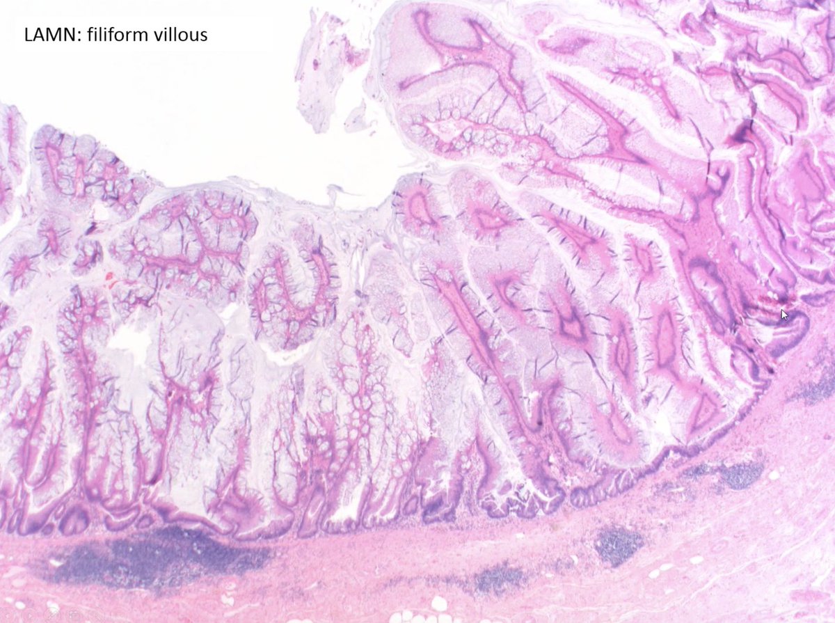 ALBoothMD's tweet photo. LAMN vs SSL -> look for your layers! @pezhouh #CAPvirtualpath #gipath https://t.co/hZEjryhooh