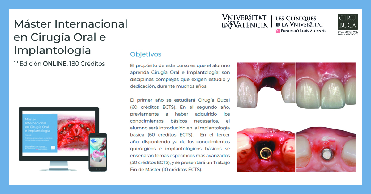 cirubuca's tweet photo. Master Internacional en Cirugía Oral e Implantología. 2020-23. 1ª Edición. Haz clic y descubre nuestro programa! 📘. https://t.co/gg74hee0Jq https://t.co/jAInWoRQcR