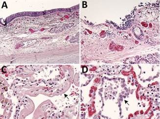 In a new study, <a href="/CDCgov/">CDC</a> pathologists found that the virus that causes #COVID19 lodges itself deep in the lungs and also affects the windpipes of elderly people with underlying medical conditions. Learn more:  go.usa.gov/xw4dc  #EIDJournal