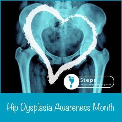 #internationalhipdysplasiaawarenessmonth #hipdysplasia #ddhwarrior  

June is not only the month where we raise awareness of clubfoot but it also coincides with the 'International Hip Dysplasia Awareness Month'. 

Follow us this week and join #TeamSteps to help raise awareness.