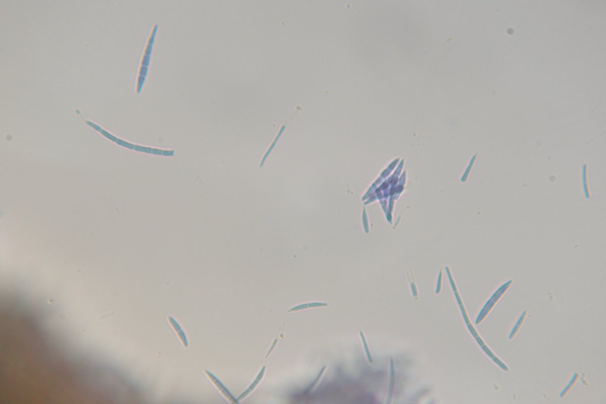 MSU Extension Plant Diagnostic Lab tweet media