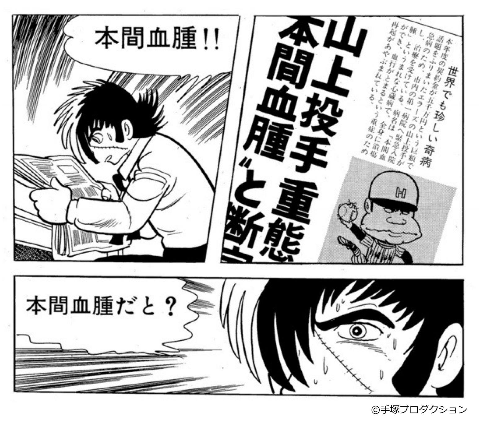 らっぱ亭 人名由来の 本間血腫 ってのもあるが ブラックジャックの作中に出てくる架空の病気ですな T Co Iswzgvw3ca Twitter