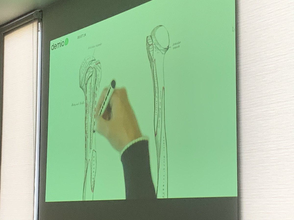 Luise Hollmann (@luisehollmann) on Twitter photo Currently watching <a href="/BacchusChris/">Chris Bacchus</a> talk about the functional anatomy of the shoulder. Very informative!Streaming live in <a href="/AllysonFlynn_AU/">Allyson Flynn</a>’s rehab gym at the <a href="/UniCanberra/">University of Canberra</a> Health Hub & to our web audience from all around the world. Thank you for this great resource <a href="/UCphysioclinic/">UC Student-Led Webinars (Physiotherapy)</a> Currently watching <a href="/BacchusChris/">Chris Bacchus</a> talk about the functional anatomy of the shoulder. Very informative!Streaming live in <a href="/AllysonFlynn_AU/">Allyson Flynn</a>’s rehab gym at the <a href="/UniCanberra/">University of Canberra</a> Health Hub & to our web audience from all around the world. Thank you for this great resource <a href="/UCphysioclinic/">UC Student-Led Webinars (Physiotherapy)</a>