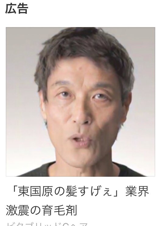 Kurita 日本人 En Twitter こんな詐欺の発毛剤広告に出てる事をなんて説明するのかな それにしてもこの醜悪な面 ひでえな