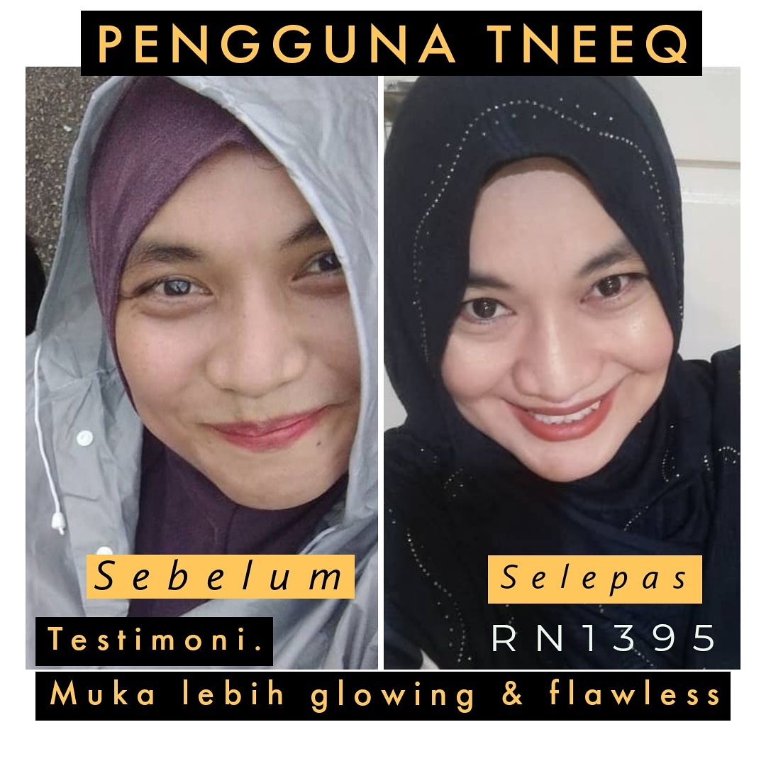 TneeqR's tweet photo. #testimoneeq 😊🅣🅝🅔🅔🅠 by Dato Rizalman Ibrahim.
* Kulit lebih halus
* Bibir kemerahan
* Baik untuk jantung
* Tidak mudah letih

Berminat boleh DM/
https://t.co/FciqZY5pED

Berminat boleh whatsapp link: https://t.co/adEqG5QLOk

Ejen kod: RN1395 🥰

#rinetwork
#tneeq
#rizalman https://t.co/ILdI5JobAG