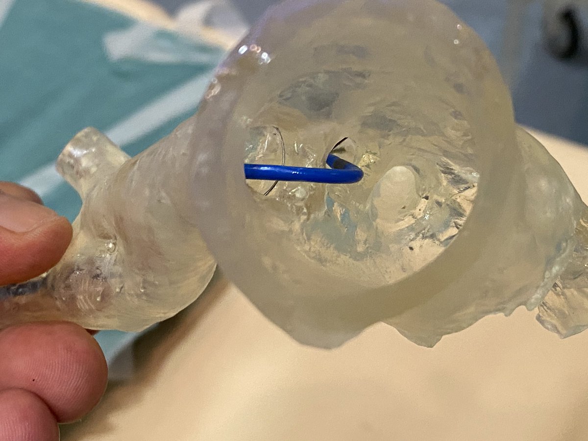 Agustín Fernández Cisnal (@afcisnal) on Twitter photo Testing <a href="/BSCCardiology/">BostonSci Cardiology</a> #Sentinel Cerebral Protection System in a 3Dprint model at <a href="/HemodinamicaVLC/">Hemodinámica-Clínico de Valencia</a> with <a href="/lvboquera/">Lidia Vernet</a> . <a href="/RadialFirstBot/">RadialFirstBot</a> <a href="/TAVRBot/">TAVR Bot</a> <a href="/shci_sec/">ACI-SEC: Hemodinamica</a> <a href="/secardiologia/">Soc Esp Cardiología</a> Testing <a href="/BSCCardiology/">BostonSci Cardiology</a> #Sentinel Cerebral Protection System in a 3Dprint model at <a href="/HemodinamicaVLC/">Hemodinámica-Clínico de Valencia</a> with <a href="/lvboquera/">Lidia Vernet</a> . <a href="/RadialFirstBot/">RadialFirstBot</a> <a href="/TAVRBot/">TAVR Bot</a> <a href="/shci_sec/">ACI-SEC: Hemodinamica</a> <a href="/secardiologia/">Soc Esp Cardiología</a>