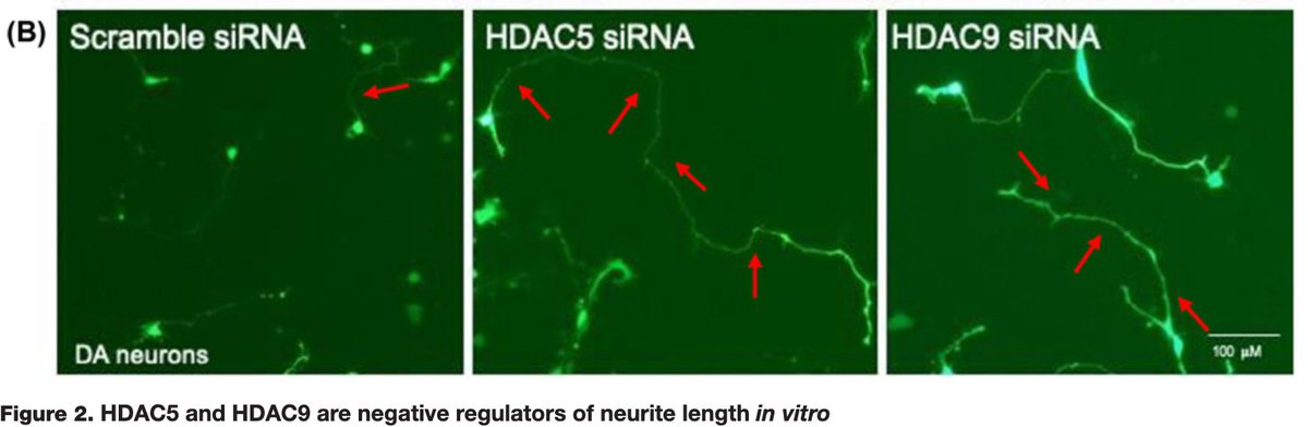 ASNeuro's tweet photo. Our review on 'The class II histone deacetylases as therapeutic targets for Parkinson’s disease' is published now in #NeuronalSignaling @PPPublishing @BiochemSoc #openaccess @OKeeffe_GW @LMCNeuro @MartinaMazzocc6
https://t.co/PCEq2S8OHC https://t.co/LMOcUWSlHc