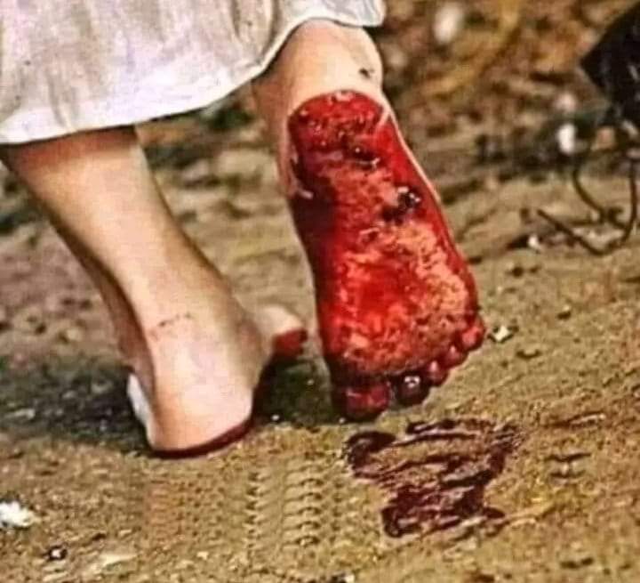 imwasimk_'s tweet image. अभी तो हमारे पैर के छाले भी नहीं गए,
और आप  आ गए वोट मांगने।
#एक_बिहारी_मजदूर