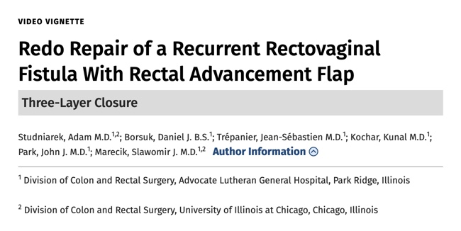 Recurrent RVFs are challenging. Take a look at the video vignette <a href="/DCRjournal/">DCRjournal</a> about our approach to treating this troublesome condition <a href="/kocharkunal1/">Kunal Kochar</a> <a href="/UICCRS/">UIC Colorectal Surgery</a> <a href="/AdvocateAurora/">Advocate Aurora Health</a> 

journals.lww.com/dcrjournal/Ful…