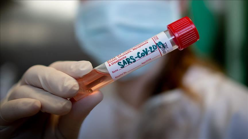 switchtvkenya's tweet photo. Kenya releases the Home Care guidelines for the asymptomatic patients.  #COVID19KE #coronavirus  
@MOH_Kenya https://t.co/kvdM9vY51S