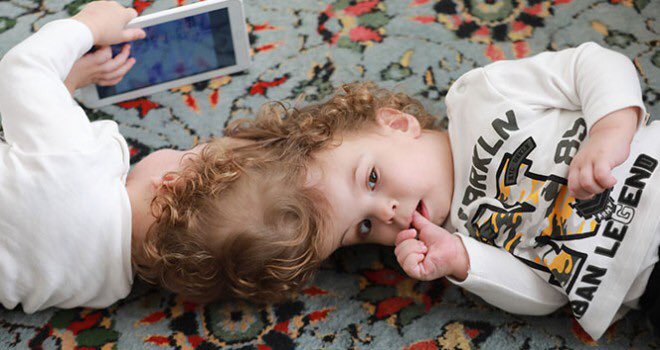 Londra'da operasyonla ayrılan siyam ikizleri Türkiye'ye döndü!