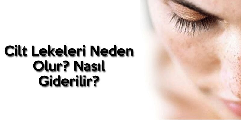 Cilt lekeleri neden olur? Nasıl giderilir? tüm merak ettikleriniz yazımızda sizleri bekliyor!

Yazımız için tıklayınız:

narecza.com/cilt-lekeleri-…

Leke giderici kremler için tıklayınız:

narecza.com/leke-kremleri