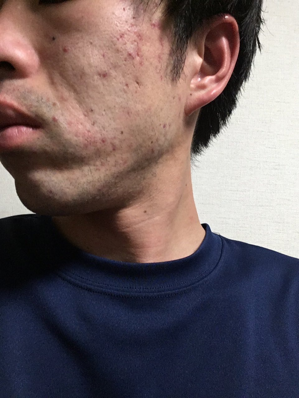 メンスキnk Nk Twitter