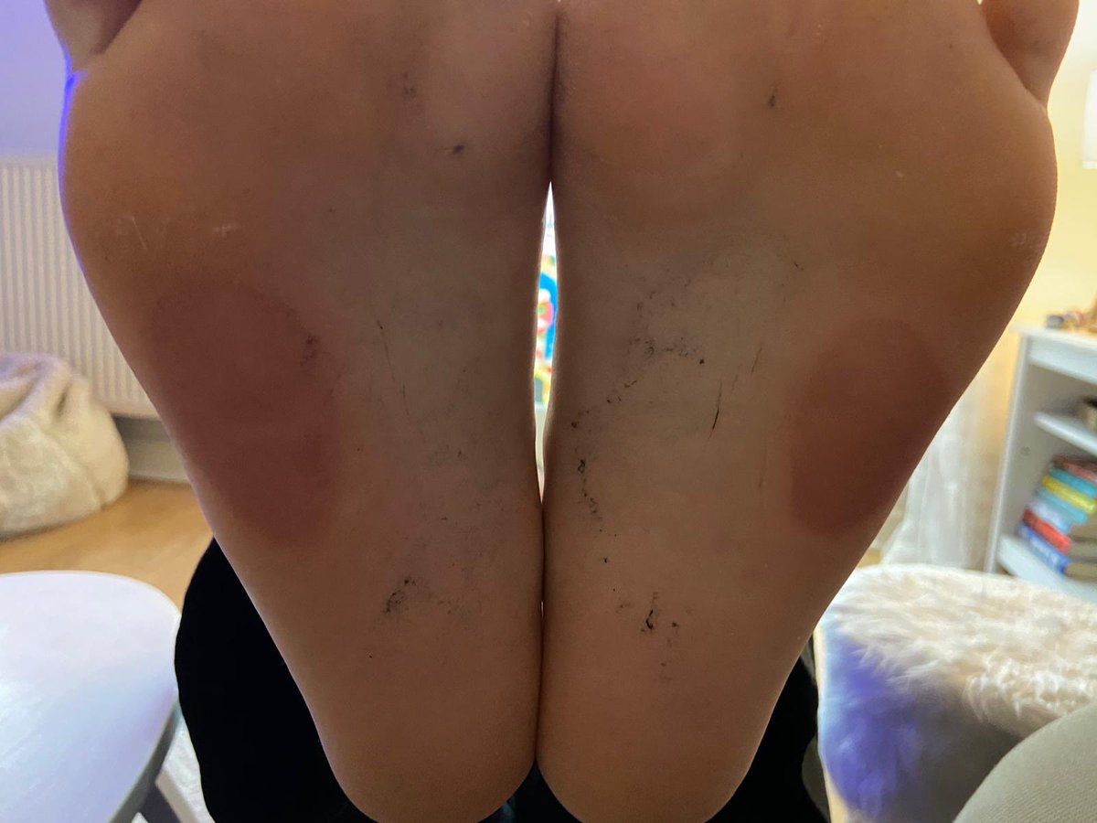 Word to the wise, don’t wear old trainers when running 🤦🏻‍♂️