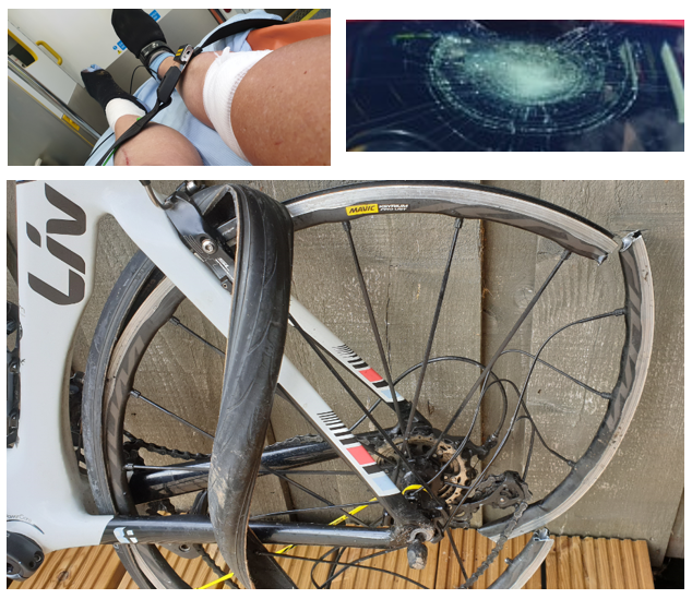 FjG_Skye's tweet photo. I'm celebrating today
1 year on
RTA 50mph hit from rear
lucky to be here, #lovecycling
All road users, respect all road users
#CycleSpace @CyclingScotland #CycleSafety #zwift https://t.co/DALSFaBXum