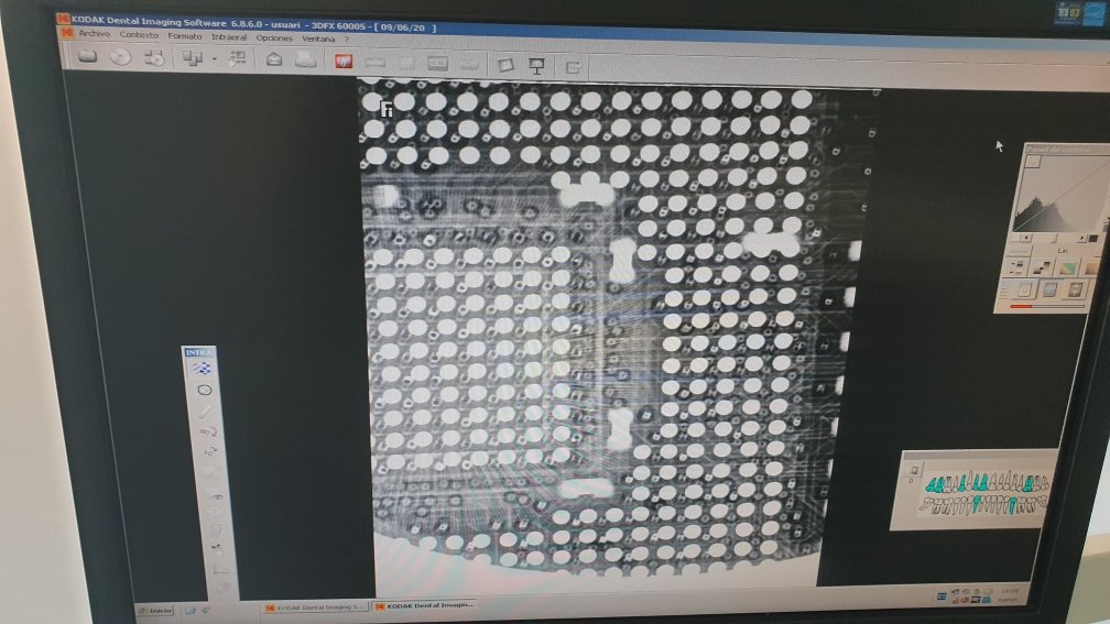 Pictures look rare because they are taken under X-Ray for checking shorts between solder joints. X-Ray sensor is small 25x25mm, not big but enough for check pads and balls connection. This is the system I use.  #3dfx