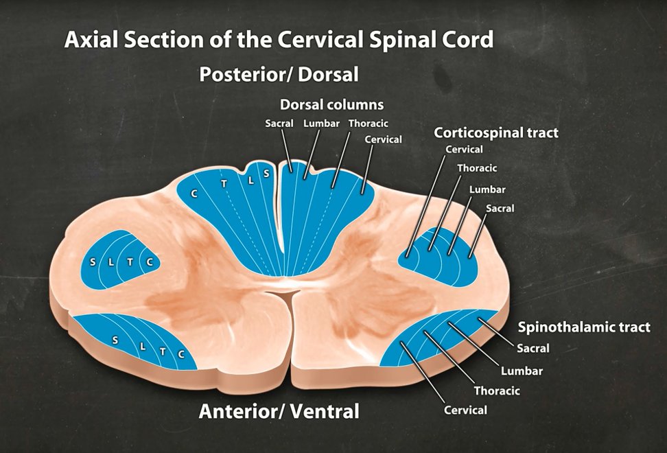 1. Corticospinal tracts (CSTs): upper motor neurons descending form brain2. Dorsal columns (DCs): carry vibration/proprioception from periphery to brain3. Spinothalamic (anterolateral) tracts (STTs): carry pain/temperature from periphery to brain