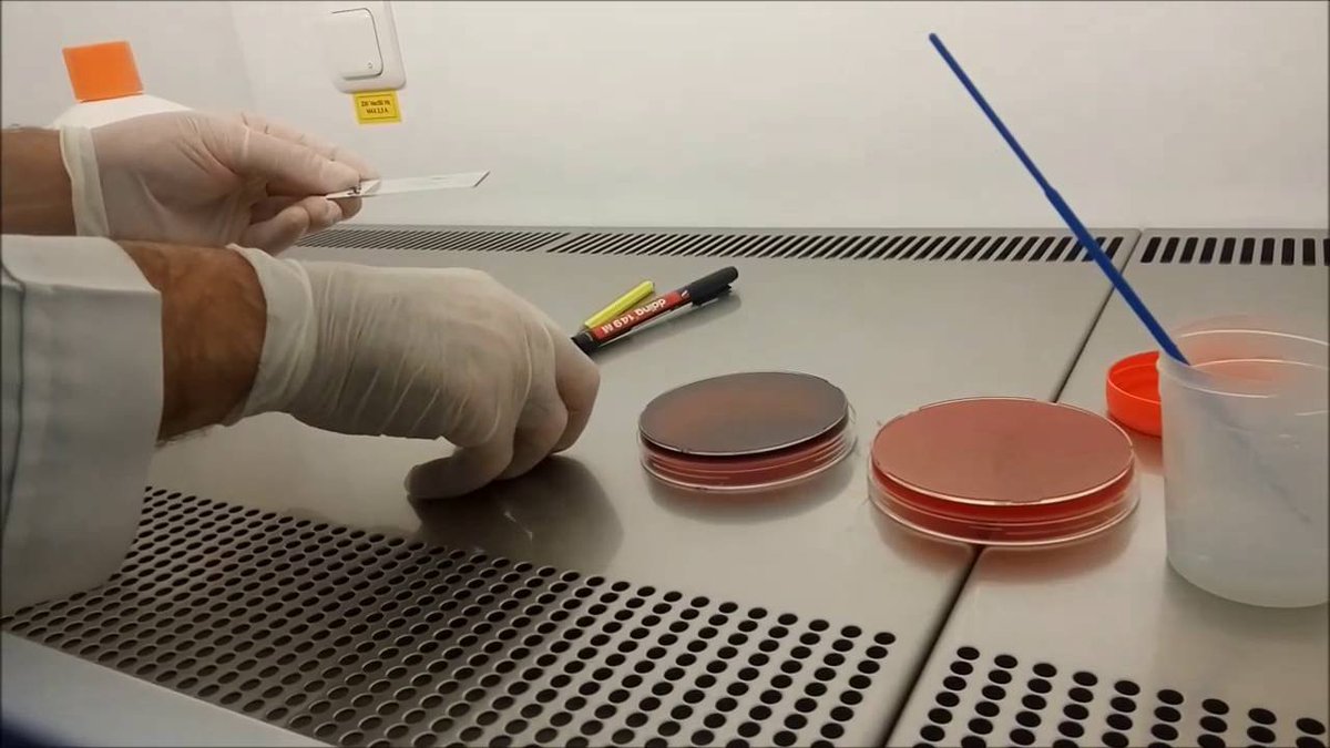 PLK Lancet Kenya on Twitter "Semen Culture is the laboratory testing