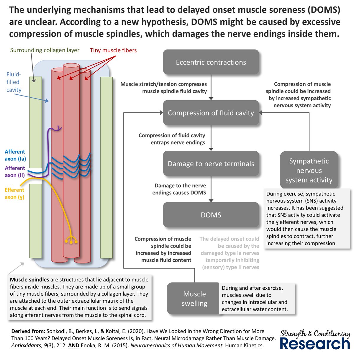 This new, alternative hypothesis suggests that delayed onset muscle soreness is not caused by inflammation, but instead by minor damage to the nerve endings within muscle spindles.