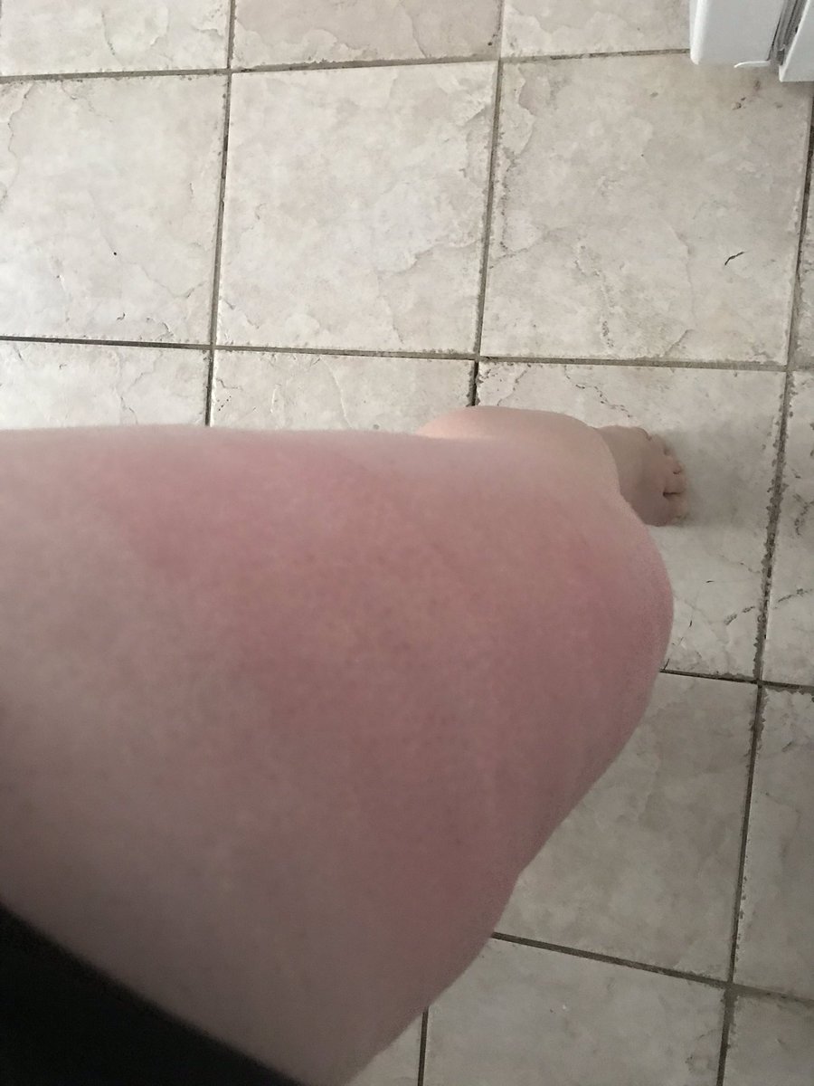 chwj2020's tweet photo. Get your Jeju Aloe for that sunburn from Avon! Works great, used it on my sunburn yesterday, fast acting cooling. Shop directly with me or online https://t.co/l9bPSyaYBP https://t.co/gJuNGn0VCn