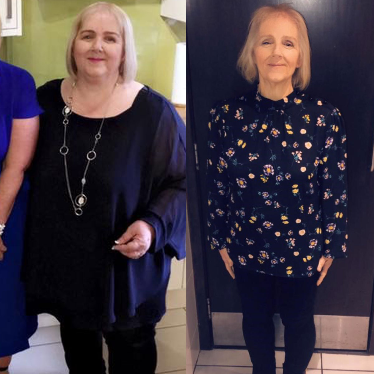 SlimmingWorld's tweet image. From taking four tablets a day for her type 2 #Diabetes to being medication-free, Tracy says that since losing 16st 2lbs with #SlimmingWorld she has transformed her health and has so much more energy thanks to the support of her group. #DiabetesWeek