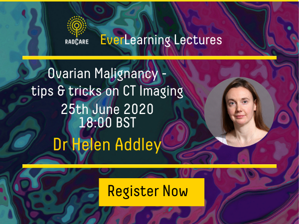 EverlightRad's tweet photo. There's still time to register to attend our next #EverLearning webinar - Ovarian Malignancy: tips and tricks on CT Imaging hosted by Dr Helen Addley on Thursday 25th June π
https://t.co/lDjIeOLOGI #CTImaging #Radiology #Radiologist #Imaging #ImagingProfessionals https://t.co/GzADPz5h6B