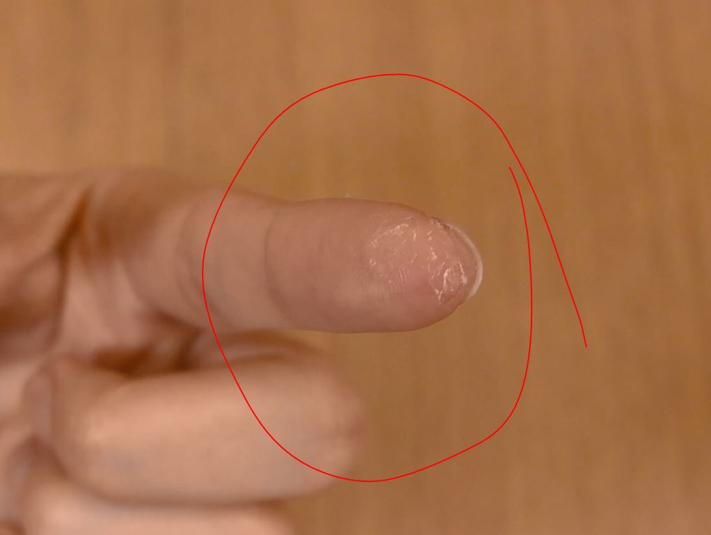 瞬間接着剤で作った指紋 瞬間接着剤が指に残ってスマホの指紋認証ができない！というツイートを