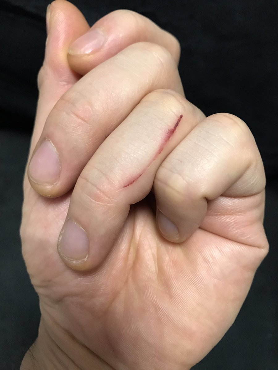 切り傷 切り傷
