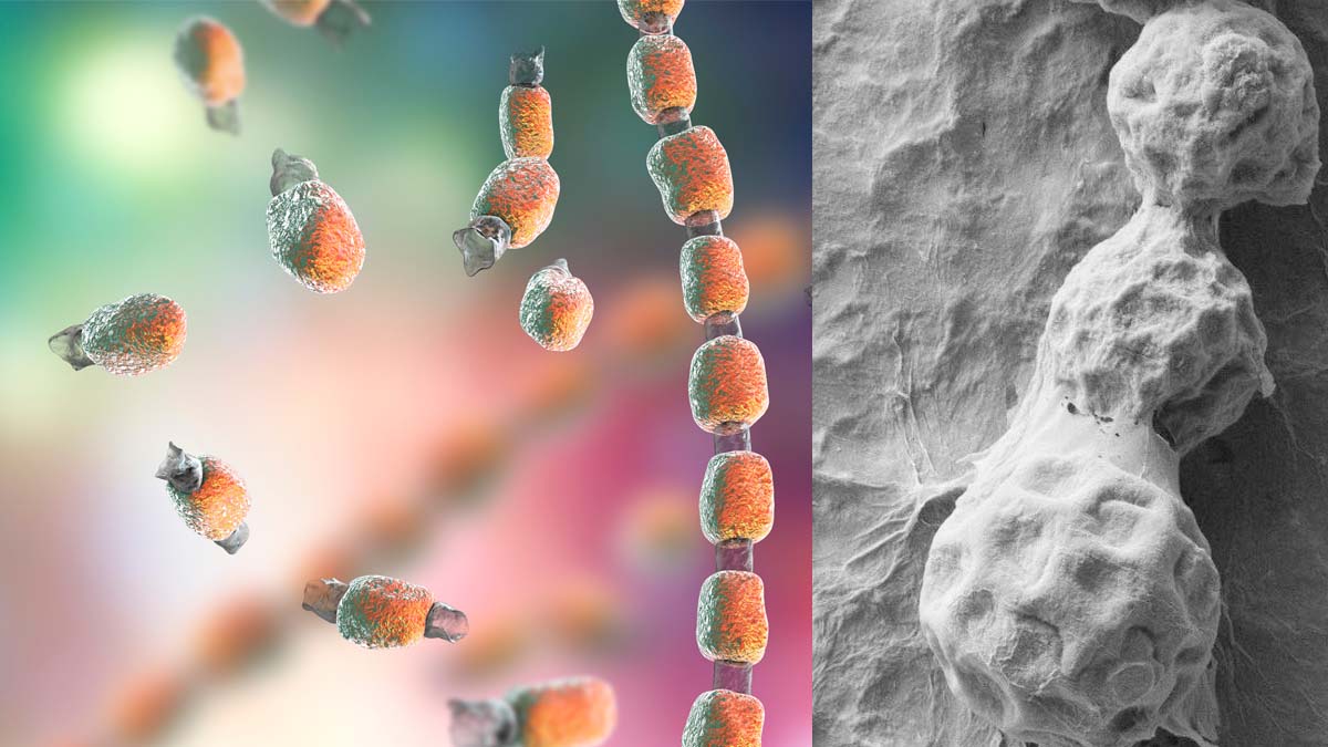 debugliesnews's tweet image. #Coccidioides fungi : Immune modulation can treat the severe and often fatal fungal infection debuglies.com/2020/06/11/coc… via @debugliesnews #Health #healthcare #healthylifestyle #HealthyLife