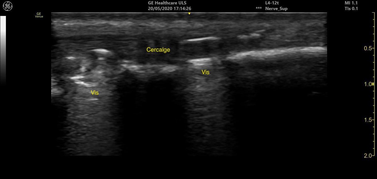 Frederic Le Saché tweet media
