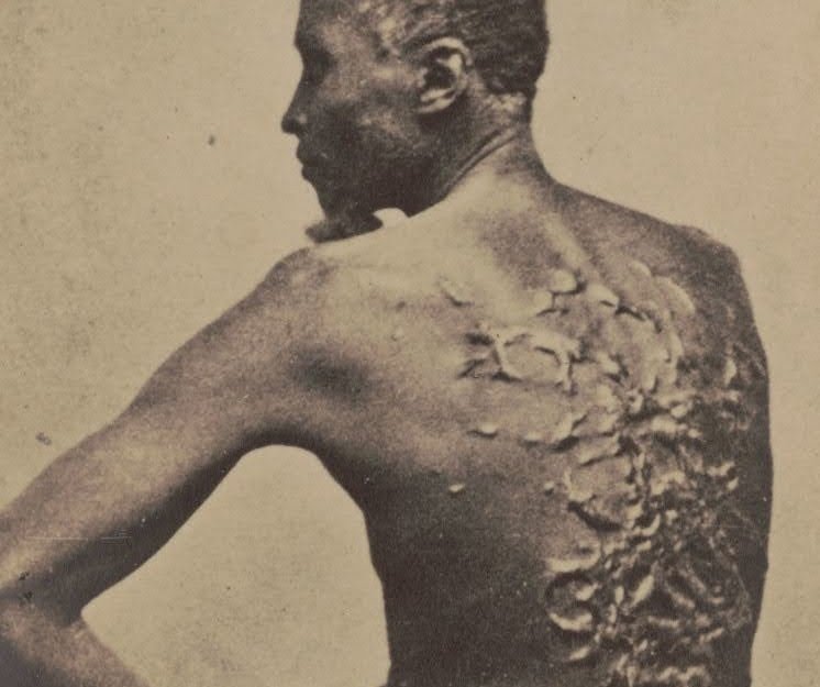 "Whipped Peter" 1863, was an African American slave who escaped a Louisiana plantation in March 1863, gaining freedom when he reached the Union camp near Baton Rouge. The incredible power of this image is the dignity of that man. He's posing, expression indifferent.