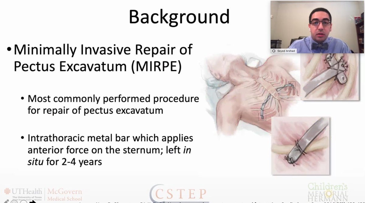 DalyaFergusonMD's tweet image. .@SArshiaArshad presenting “Decreased opioid use and length of stay with cryoanalgesia in minimally invasive repair of pectus excavatum” for @UTHealthSurg resident research day. @UTH_Pedisurg @UTH_CSTEP @KuoJenTsao
