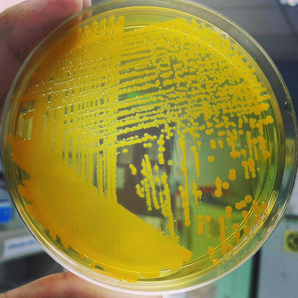 mICROBIOsh's tweet photo. Vibrio cholerae en agar TCBS. 💛
El #cólera es una infección intestinal aguda causada por la ingestión de alimentos o agua contaminada con la bacteria #Vibrio #cholerae. https://t.co/CwIMOwI1uG