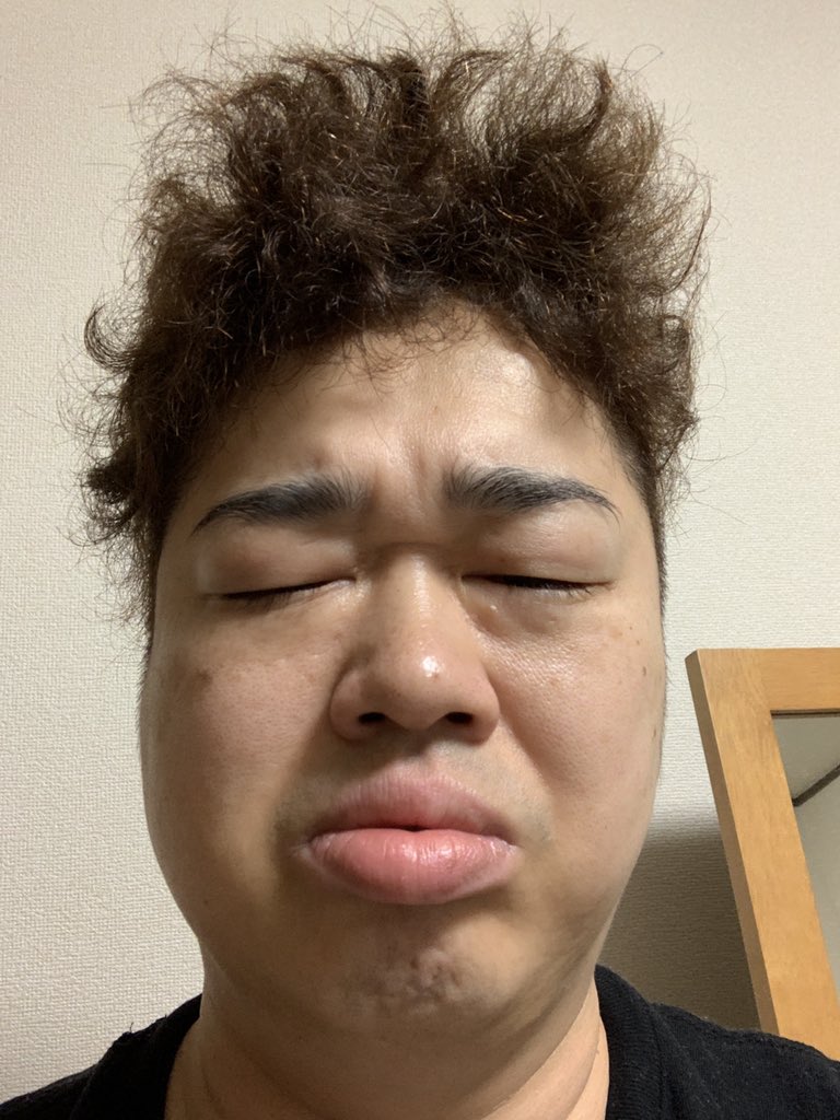 堀内馬鹿祭 本日の のふり 親知らず 抜いたら顔が腫れたよ のふり ほんとは41年生きてきて 寝起き1番のむくみを経験しただけ 起きたのに目が開かない状態でした 我ながらどブス過ぎて笑ってしまった 酷い顔 平和な朝 のふり 自粛緩和 日常が